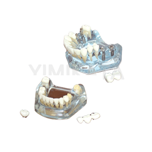 牙科教学模型,牙科材料,牙科诊所,牙医,